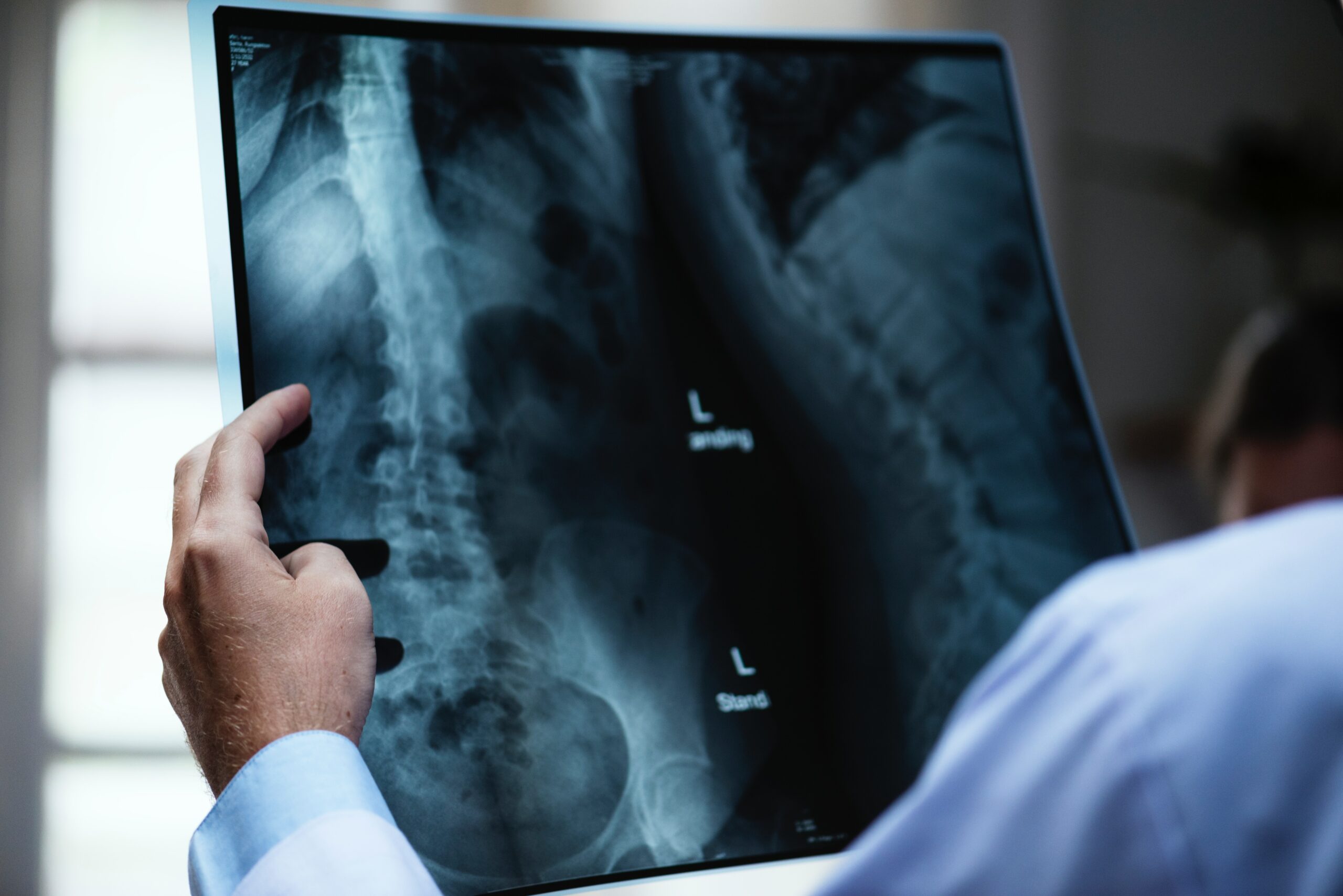 Dutch medical AI startup Aidence raises €10 million