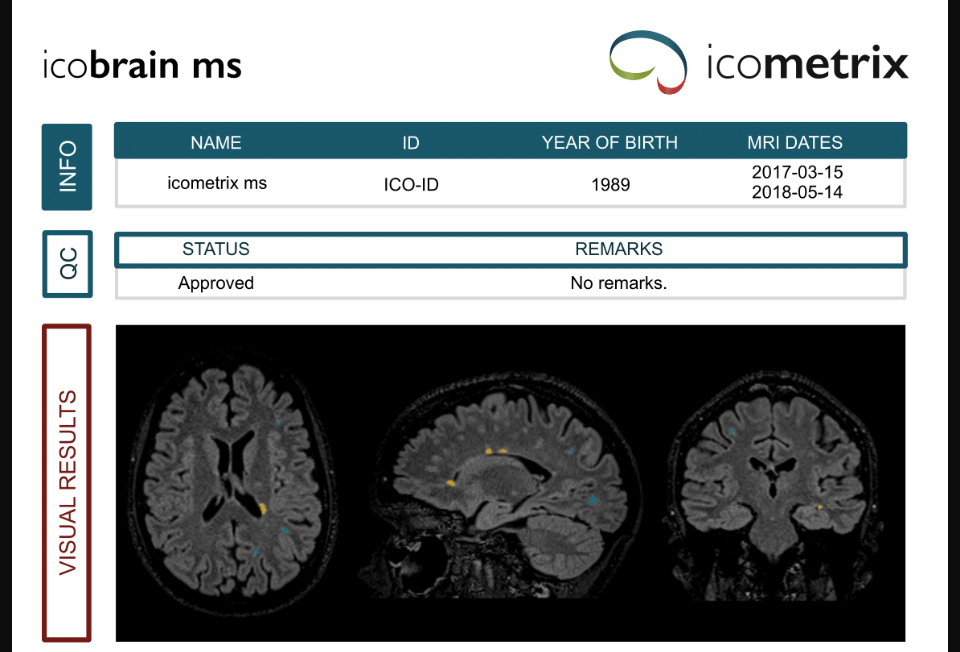 Belgium's icometrix raises $18 million to boost development of its brain imaging AI solutions