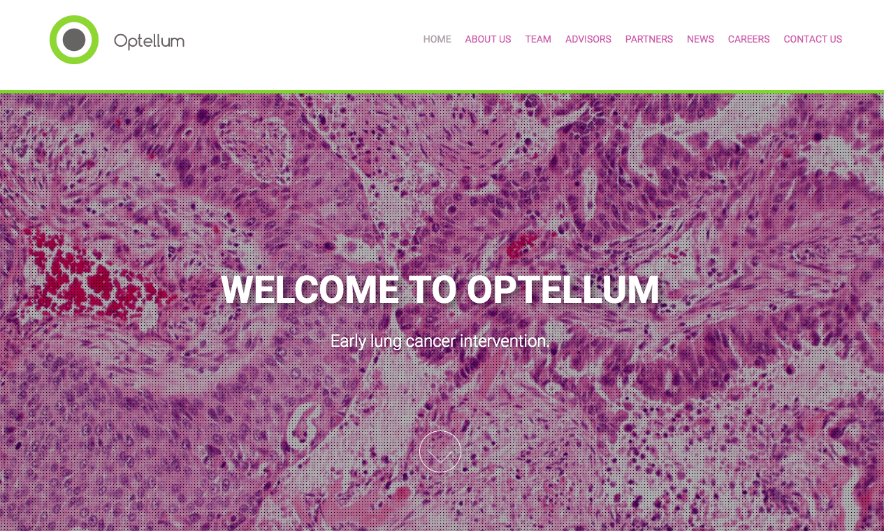 Optellum scores £1 million in funding from Luminous Ventures to tackle lung cancer diagnosis with AI