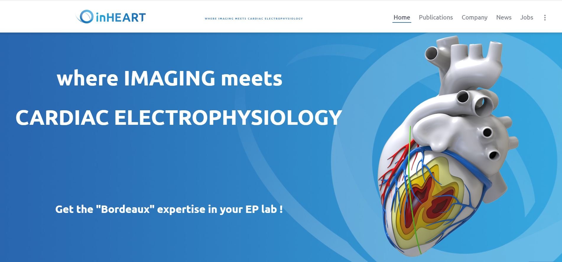 French startup inHEART raises €3.7 million to improve cardiac treatments with medical imaging and AI