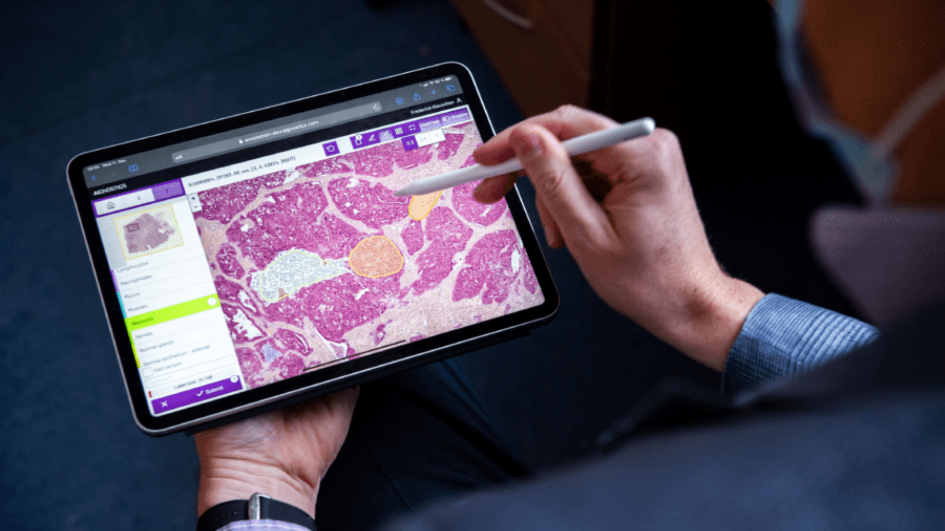 Berlin-based Aignostics scoops €14 million to decode diagnostics with AI-driven pathology platform