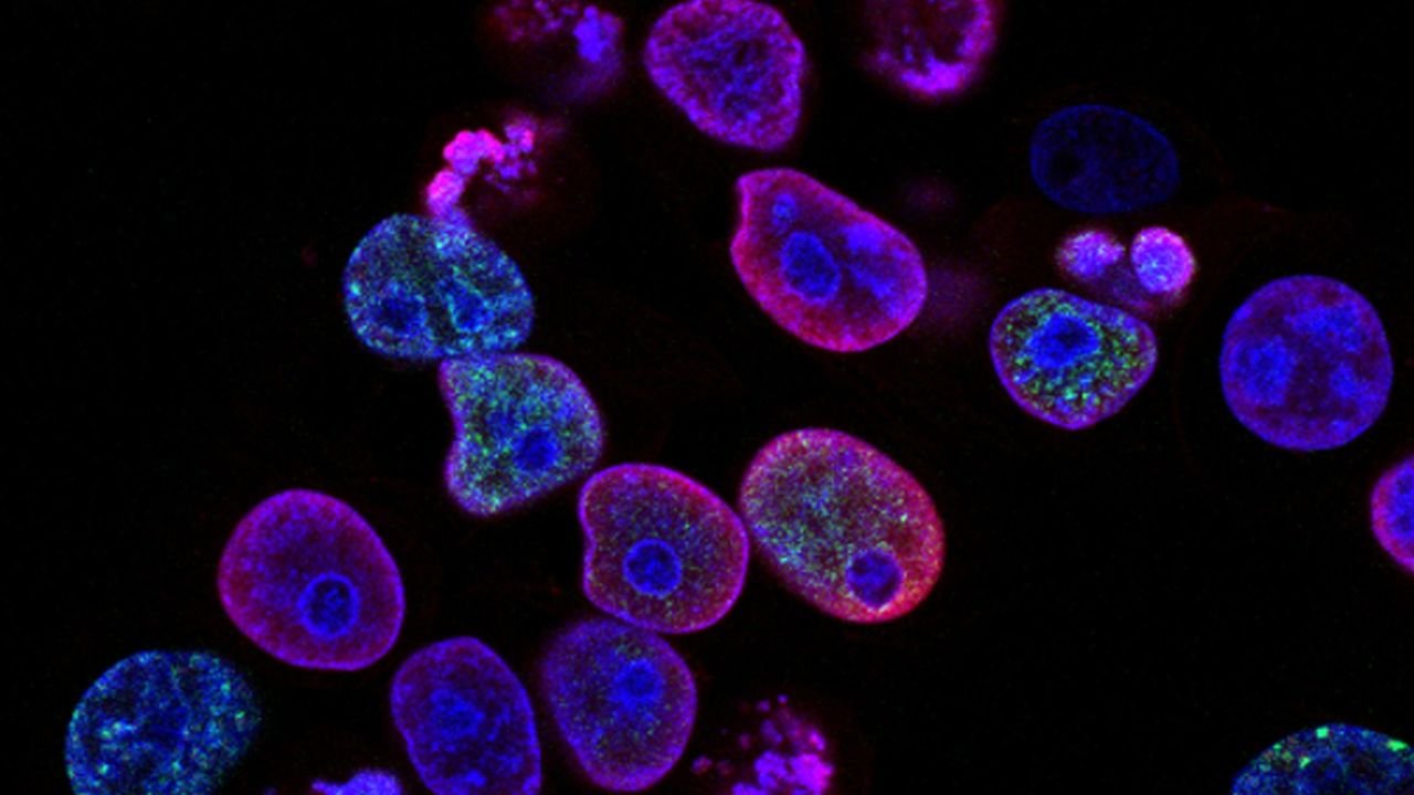 Austria's Sarcura raises €7 million to bring 