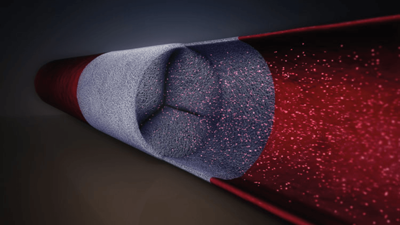Dutch medtech firm Xeltis secures €12.5M from EIC Fund